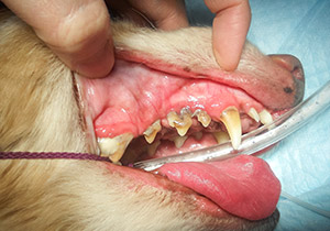 歯周病の症例